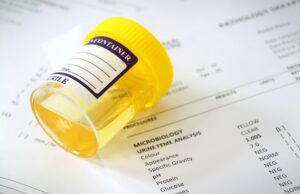 Sen. Jeremy Hutchinson's&nbsp;measure would require new applicants for unemployment benefits to submit to a drug screen; current unemployment recipients would be randomly tested for benefits on a frequency determined by the state's Department of Workforce Services.