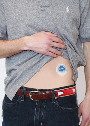 The insulin patch pump from Fayetteville's SFC Fluidics.